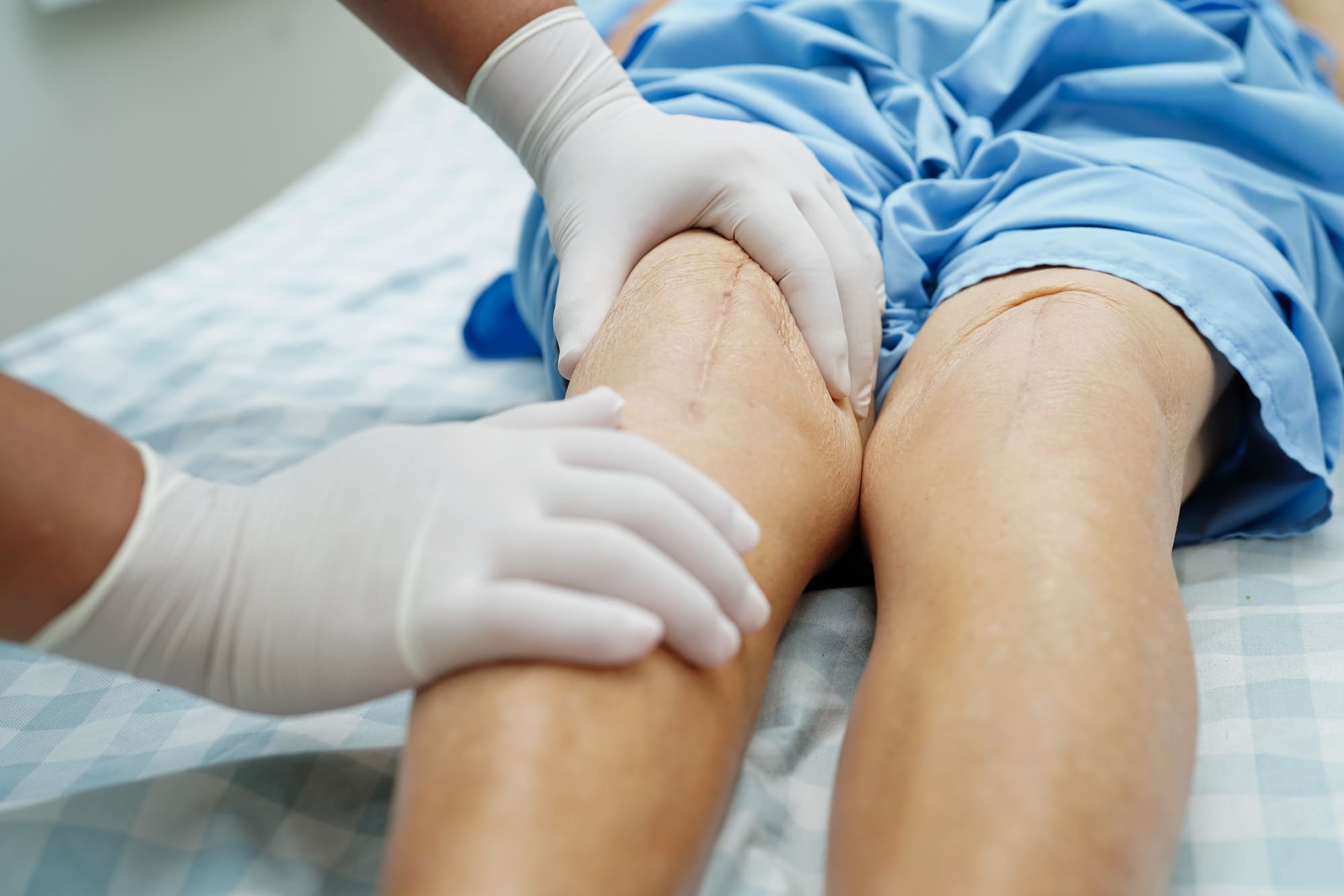 Knee Replacement Surgery - After Work-related Injury (1)